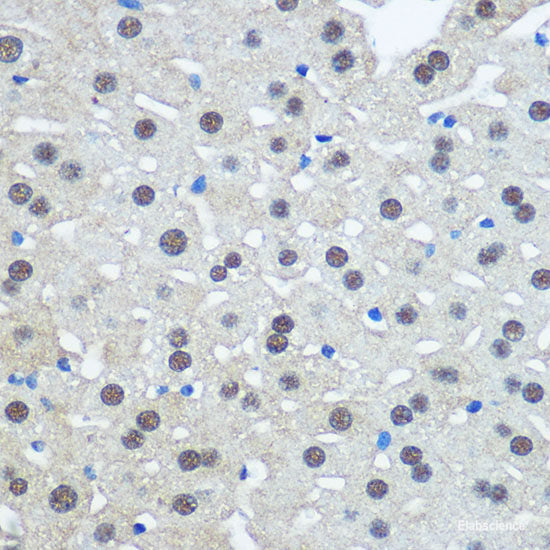 Immunofluorescence analysis of C6 cells using IRAK1 Polyclonal Antibody at dilution of 1:100. Blue: DAPI for nuclear staining.