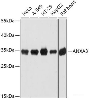 Western blot analysis of extracts of Mouse thymus using RAG1 Polyclonal Antibody at dilution of 1:3000.