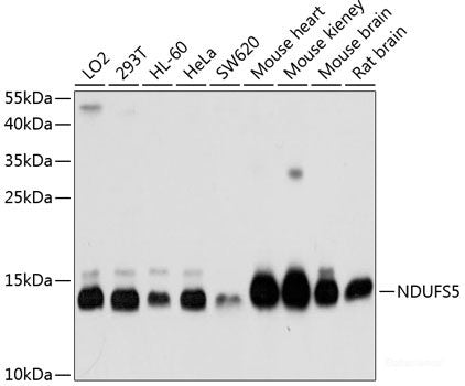 Western blot analysis of extracts of various cell lines using MTCH2 Polyclonal Antibody at dilution of 1:3000.