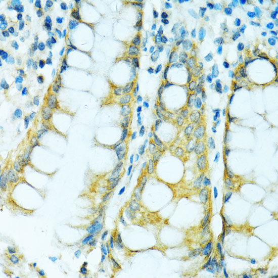 Immunohistochemistry of paraffin-embedded Rat ovary using ZNF416 Polyclonal Antibody at dilution of 1:100 (40x lens).