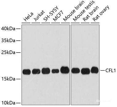 Immunofluorescence analysis of HeLa cells using DCTN1 Polyclonal Antibody