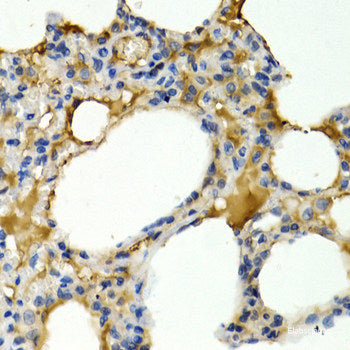 Immunofluorescence analysis of C6 cells using E2F1 Polyclonal Antibody at dilution of 1:100 (40x lens). Blue: DAPI for nuclear staining.
