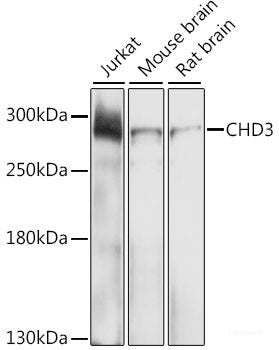 Western blot analysis of extracts of various cell lines using HMGB1 Polyclonal Antibody at dilution of 1:1000.