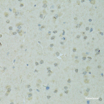 Western blot analysis of extracts of various cell lines using GZMB Polyclonal Antibody at dilution of 1:1000.