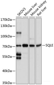Immunohistochemistry of paraffin-embedded Mouse brain using CDK10 Polyclonal Antibody at dilution of 1:100 (40x lens).