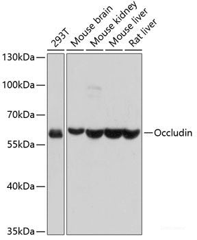Immunofluorescence analysis of Rat brain using GRIN2B Polyclonal Antibody at dilution of 1:100. Blue: DAPI for nuclear staining.