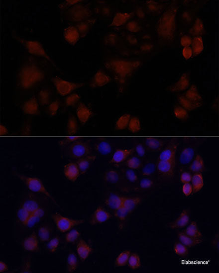 Western blot analysis of extracts of Raji cells using PAX5 Polyclonal Antibody at dilution of 1:3000.