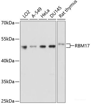 Immunohistochemistry of paraffin-embedded Human colon carcinoma using KRT81 Polyclonal Antibody at dilution of 1:100 (40x lens).