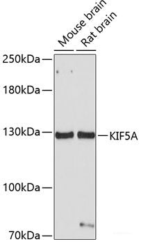 Immunohistochemistry of paraffin-embedded Rat heart using PRPH Polyclonal Antibody at dilution of 1:100 (40x lens).