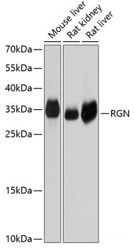Immunofluorescence analysis of C6 cells using SLC20A1 Polyclonal Antibody at dilution of 1:100. Blue: DAPI for nuclear staining.
