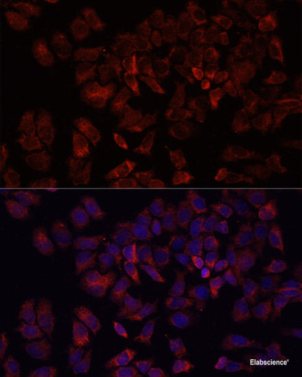 Western blot analysis of extracts of HepG2 cells using SCAMP2 Polyclonal Antibody.