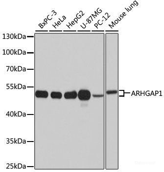Immunohistochemistry of paraffin-embedded Human stomach using USH1C Polyclonal Antibody at dilution of 1:100 (40x lens).