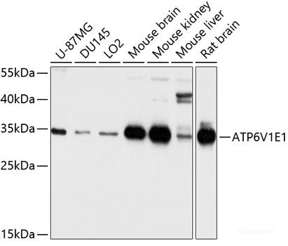 Immunohistochemistry of paraffin-embedded Human lung cancer using BCAS2 Polyclonal Antibody at dilution of 1:100 (40x lens).