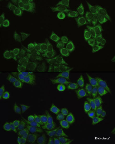 Western blot analysis of extracts of various cell lines using EXOSC8 Polyclonal Antibody at dilution of 1:1000.
