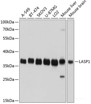 Western blot analysis of extracts of various cell lines using IFT81 Polyclonal Antibody at dilution of 1:3000.