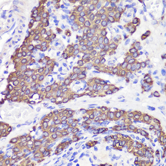 Immunofluorescence analysis of A549 cells using IWS1 Polyclonal Antibody