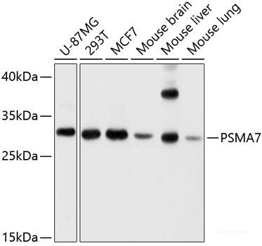 Western blot analysis of extracts of various cell lines using SPK Polyclonal Antibody at dilution of 1:1000.