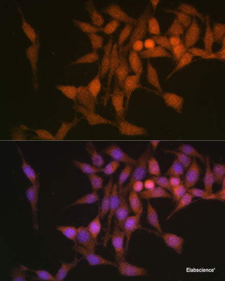 Immunofluorescence analysis of U2OS cells using PCDHA6 Polyclonal Antibody at dilution of 1:100. Blue: DAPI for nuclear staining.