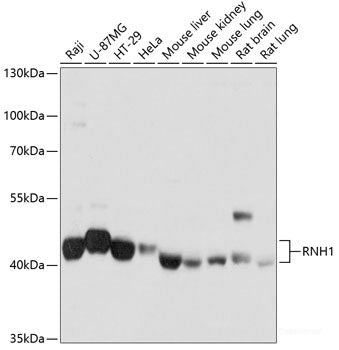 Western blot analysis of extracts of MDA-MB-453 cells using OTUD7B Polyclonal Antibody.