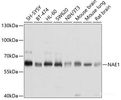 Immunohistochemistry of paraffin-embedded Human prostate using FMR1NB Polyclonal Antibody at dilution of 1:100 (40x lens).