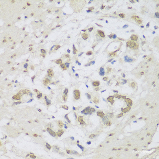 Western blot analysis of extracts of Rat brain using CD81 Polyclonal Antibody at dilution of 1:1000.