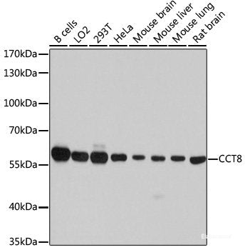 Western blot analysis of extracts of Mouse heart using FABP3 Polyclonal Antibody at dilution of 1:1000.