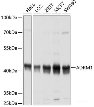 Western blot analysis of extracts of various cell lines using PDZK1 Polyclonal Antibody at dilution of 1:1000.