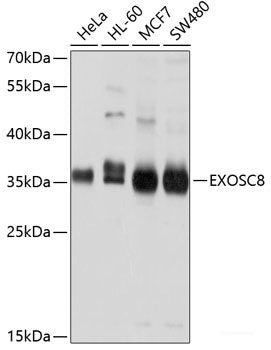Immunohistochemistry of paraffin-embedded Human liver damage using S100A12 Polyclonal Antibody at dilution of 1:100 (40x lens).