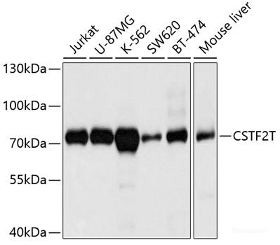 Immunohistochemistry of paraffin-embedded Human prostate using SLC4A4 / NBC Polyclonal Antibody at dilution of 1:100 (40x lens).