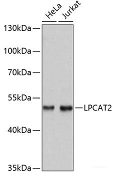 Immunohistochemistry of paraffin-embedded Rat heart using TYROBP Polyclonal Antibody at dilution of 1:100 (40x lens).