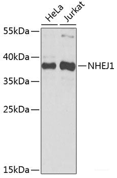 Immunohistochemistry of paraffin-embedded Rat brain using STXBP1 Polyclonal Antibody at dilution of 1:100 (40x lens).
