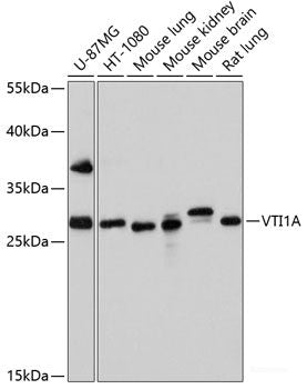 Immunohistochemistry of paraffin-embedded Human colon using PI3 Polyclonal Antibody at dilution of 1:100 (40x lens).