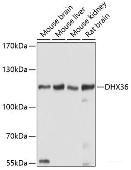 Immunohistochemistry of paraffin-embedded Human tonsil using HSD17B10 Polyclonal Antibody at dilution of 1:100 (40x lens).