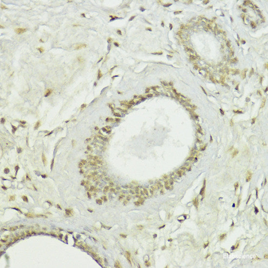 Immunofluorescence analysis of HeLa cells using CDC34 Polyclonal Antibody