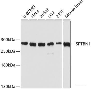 Immunofluorescence analysis of U2OS cells using CPE Polyclonal Antibody