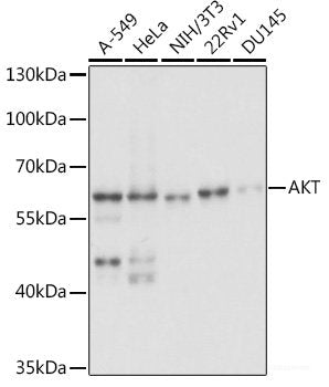 Immunohistochemistry of paraffin-embedded Human prostate using INSL3 Polyclonal Antibody at dilution of 1:100 (40x lens).