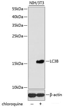 Immunofluorescence analysis of Human spleen using SLAMF7 Polyclonal Antibody at dilution of 1:100 (40x lens). Blue: DAPI for nuclear staining.