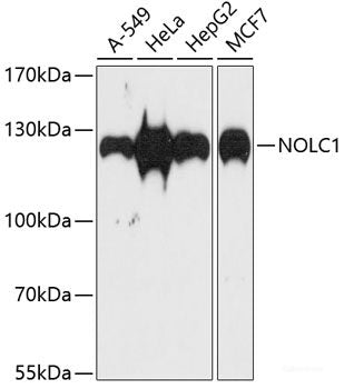Western blot analysis of extracts of BT-474 cells using TIA1 Polyclonal Antibody at dilution of 1:1000.