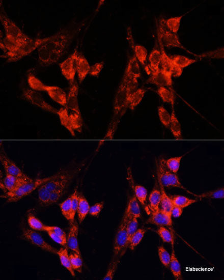 Immunohistochemistry of paraffin-embedded Rat brain using COG2 Polyclonal Antibody at dilution of 1:100 (40x lens).
