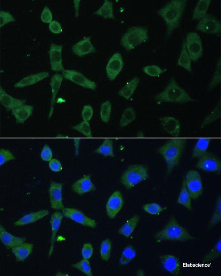 Immunohistochemistry of paraffin-embedded Human stomach using BNIP3L Polyclonal Antibody at dilution of 1:100 (40x lens).