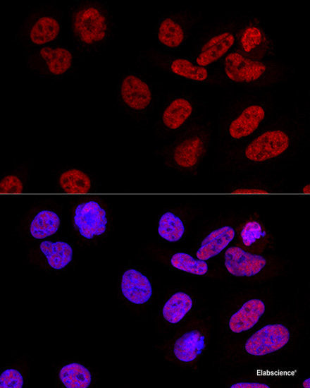 Immunohistochemistry of paraffin-embedded Mouse brain using GALT Polyclonal Antibody at dilution of 1:100 (40x lens).