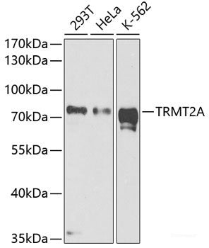 Immunofluorescence analysis of HeLa cells using KCNA2 Polyclonal Antibody
