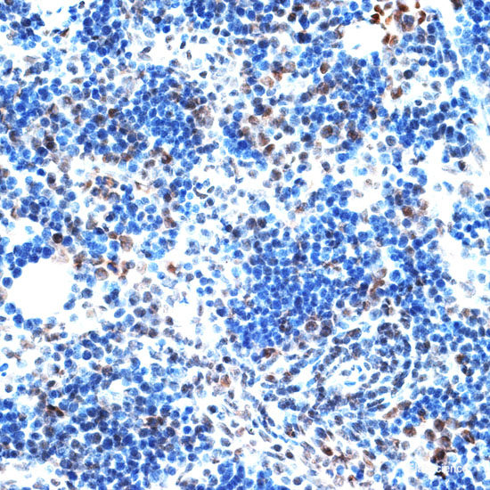 Immunofluorescence analysis of U2OS cells using PGM1 Polyclonal Antibody