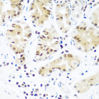 Immunofluorescence analysis of U2OS cells using PHYH Polyclonal Antibody
