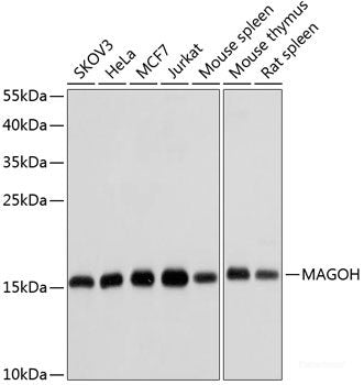 Immunofluorescence analysis of HeLa cells using TAC3 Polyclonal Antibody