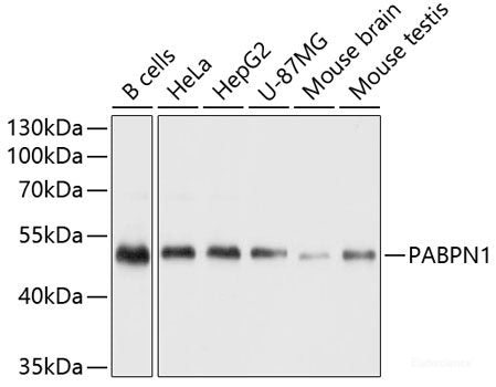 Immunohistochemistry of paraffin-embedded Human liver using SERPINA7 Polyclonal Antibody at dilution of 1:100 (40x lens).
