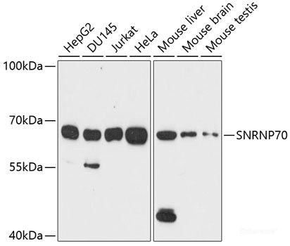 Immunofluorescence analysis of C6 cells using ZWINT Polyclonal Antibody at dilution of 1:100 (40x lens). Blue: DAPI for nuclear staining.