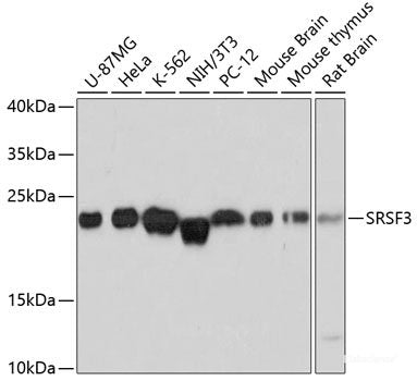 Immunohistochemistry of paraffin-embedded Rat brain using PDP1 Polyclonal Antibody at dilution of 1:100 (40x lens).