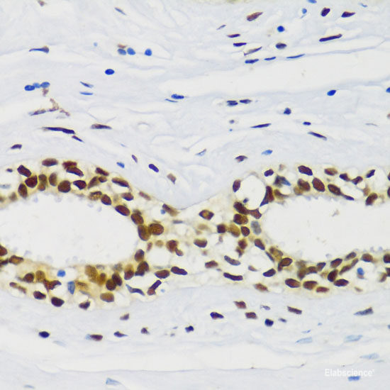 Western blot analysis of extracts of various cell lines using PCGF1 Polyclonal Antibody.