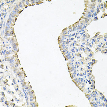 Immunofluorescence analysis of A549 cells using DTYMK Polyclonal Antibody